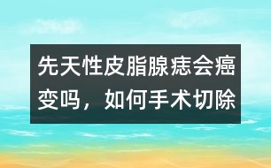 先天性皮脂腺痣會(huì)癌變嗎，如何手術(shù)切除