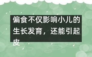 偏食不僅影響小兒的生長(zhǎng)發(fā)育，還能引起皮膚病